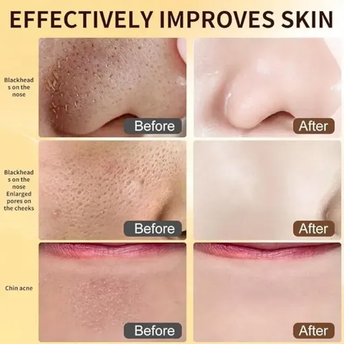 Esencia Hidratante Exfoliante Con Arroz Negro