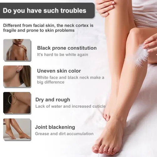 Crema Blanqueadora Hidratante Corporal Snow Bleach Aclarante De Piel Zonas Íntimas Axilas Rodillas Codos Ingle Aclara Manchas Tono Uniforme Cuidado Personal Cosmética