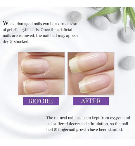 Base Fortalecedora Nail Tek Xtra 4 0,5 Oz