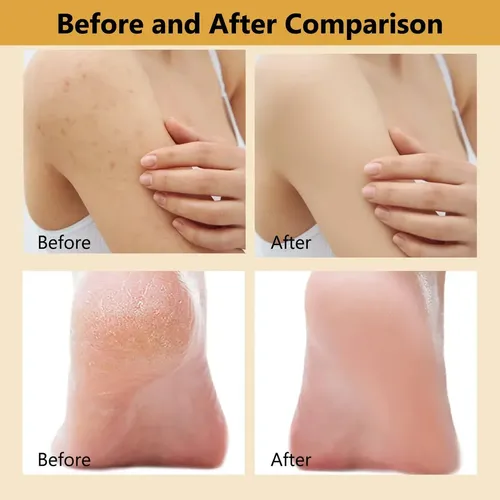 Spray Exfoliante Corporal Con Ácido Kójico Y Cúrcuma,