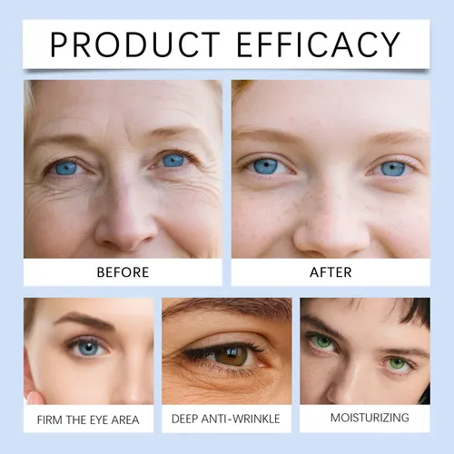 Parches Ojos Caffeine Antiedad Ojeras Tipo De Piel