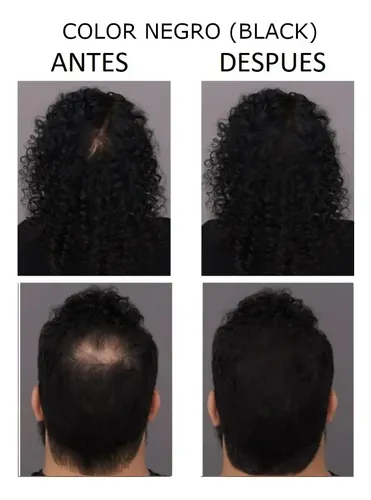 Fibras Capilares De Keratina 28gr Frasco Pelo Calidad Toppik