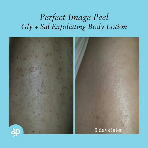 Loción Corporal Exfoliante Perfect Image Gly + Sal 240 Ml