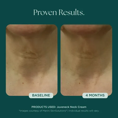 Crema Para El Uello Juveneck De Marini Skin Solutions