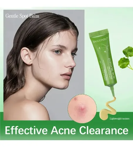 .t 2025 Fy Crema For Eliminar El Acné Centella Asiática T.