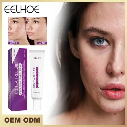 3 Unidades Crema Azelaica Un 10% Ácido Azelaico, C Acneica