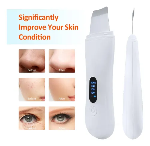 Máquina Depuradora Facial Profunda Ultrasónica