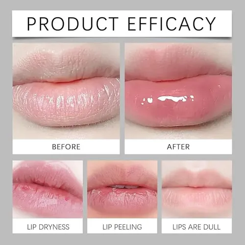 Crema Para Labios Belani Fordyce, Eliminador De Manchas Ford