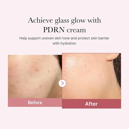 Medicube Salmon Dna Pdrn Crema Hidratante Hialurónica Rosa Día/noche Todo Tipo De Piel