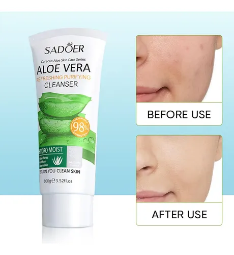 Limpador Facial Aloe Humectante Limpieza Poros