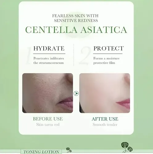 Tónico Facial Bioaqua Centella Asiática Reparador Anti Acné