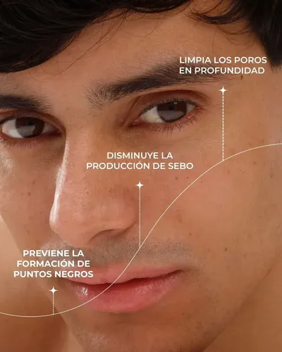 Tónico Kosmos Purificante con Ácido Salicílico 2% y Zinc para Piel Grasa