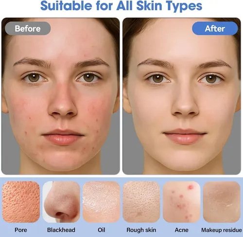 Limpiador Facial Eléctrico Recargable Blanco Impermeable