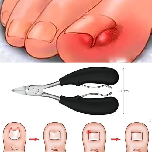 6×cortaúñas For Uñas Encarnadas O Piel Muerta Gruesa. .
