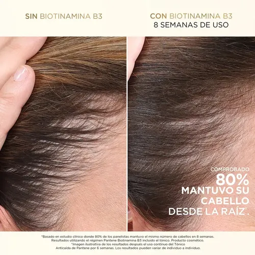 Shampoo Pantene Anticaída+ Biotinamina B3 300 ml