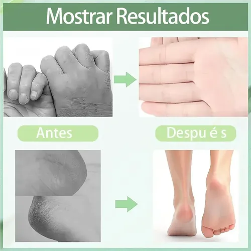 Crema Para Pies 60% Urea + 2% Ácido Salicílico 40 G Blanco
