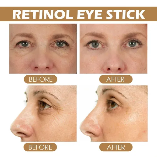 Eelhoe Retinol Eye Cream Stick Mejora Las Bolsas De Los Ojos