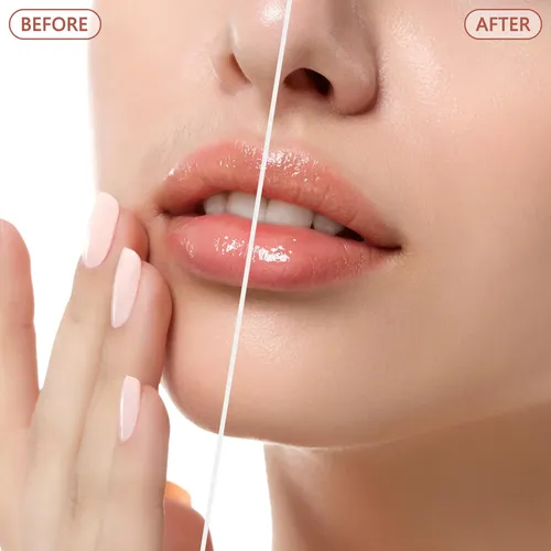 Removedor De Vello Facial Eléctrico Oro Rosa Modelo Tv