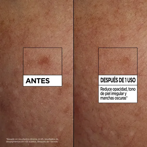 Serum Limpiador Garnier Anti Manchas Vitamina C 100ml