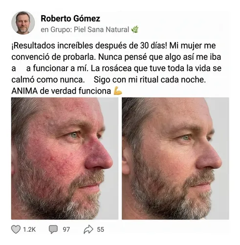 Anima Crema Natural Correctora Rosácea Y Acné 110g