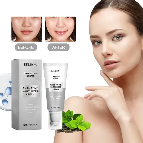 Crema Facial Hidratante Eelhoe Para Rojeces E Imperfecciones