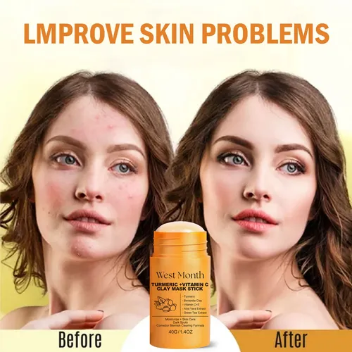 Mascarilla De Arcilla Iluminadora Con Cúrcuma West Month
