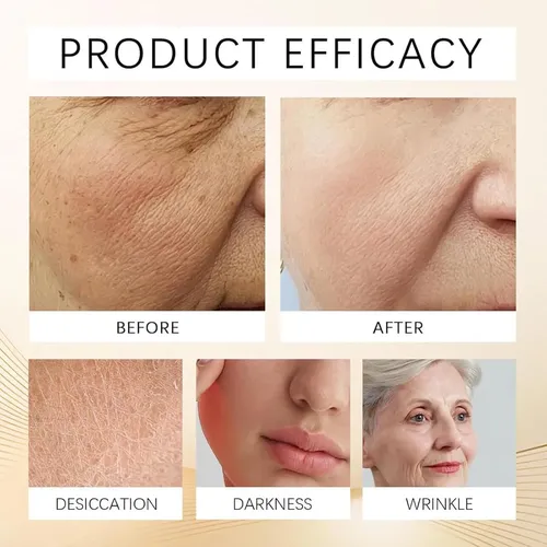 Crema Instantánea Para Ojos Sin Filtro De Alta Calidad Eye N