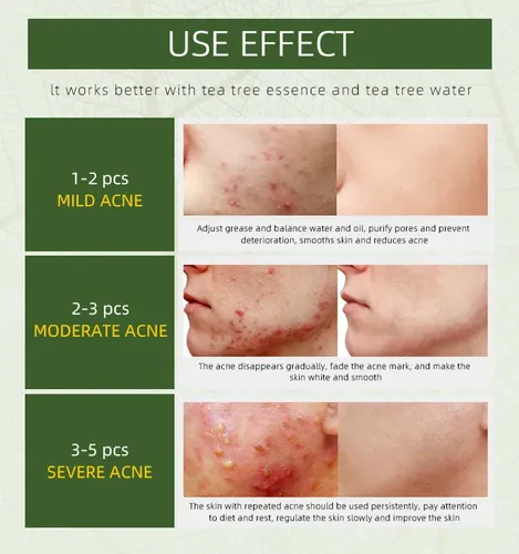 2026 2 Crema Herbal Antiacné Controla Granos -pls