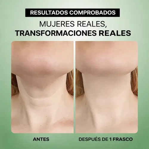 Crema Reafirmante Cuello Eliré Anti Envejecimiento Y Arrugas