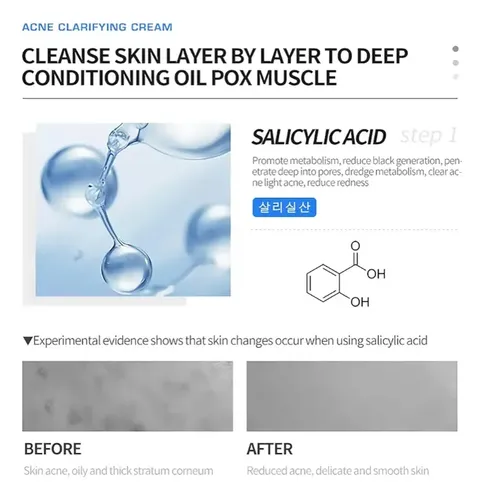 Crema Facial Aclarante Anti Acné Deleventh Con Pantenol