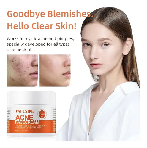 Crema Facial Antiacné Apta Para Todo Tipo De Piel Sensible.