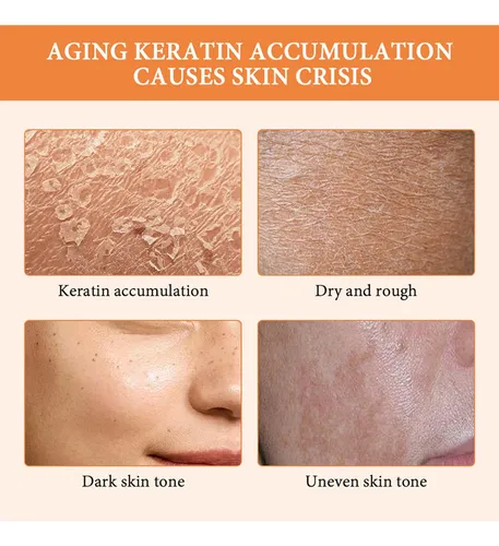 Exfoliante En Gel Exfoliante De Naranja 2026, Limpieza Profu