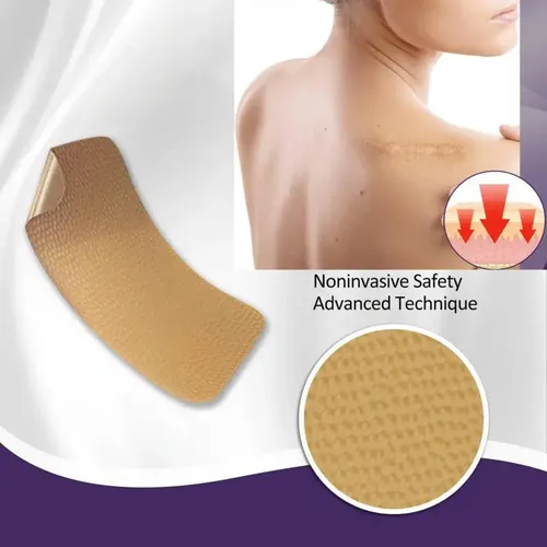 Láminas Indoloras Con Cinta Adhesiva De Silicona Para Repara