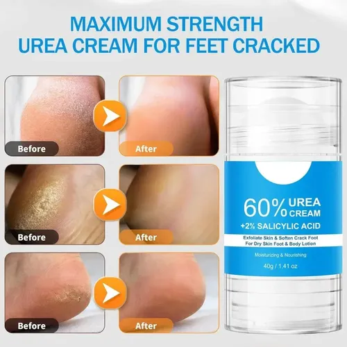 Ai //crema De Urea De Máxima Potencia For Pies, 2 Unidades