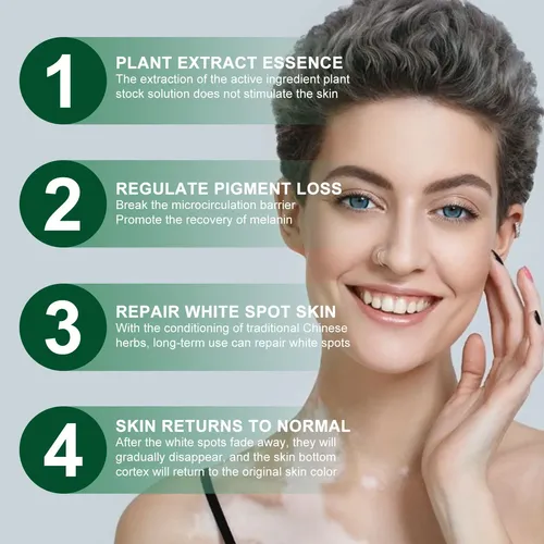 Zgq Una Crema Blanca For El Vitíligo, Aceite De Vitiligo K