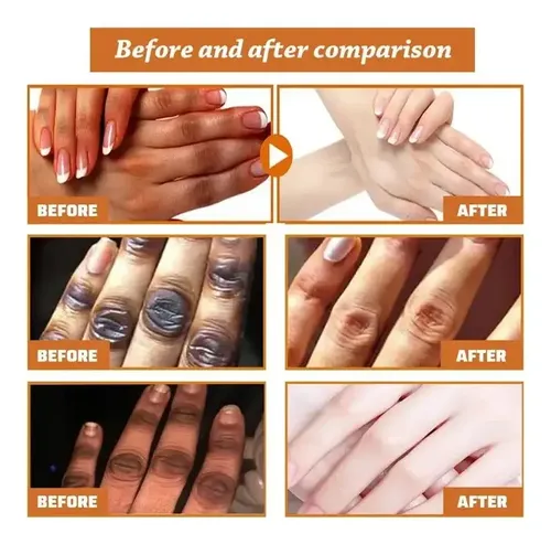 Crema Blanqueadora Y Abrillantadora Knuckles Fastx