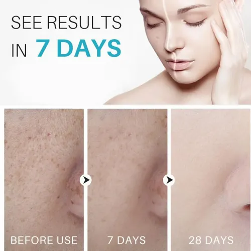 Crema Correctora De Manchas Oscuras Ideal Para Manchas
