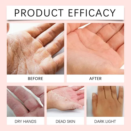 Crema Para Las Manos Con Retinol Antienvejecimiento,