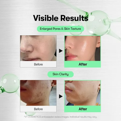 Esencia Facial Iluminadora Cuidado Piel 50 Ml Todo Tipo De Piel Día/noche