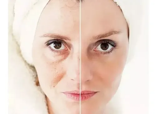 Renovage Crema Antiage Lidherma Antiarrugas Renovadora 30gr