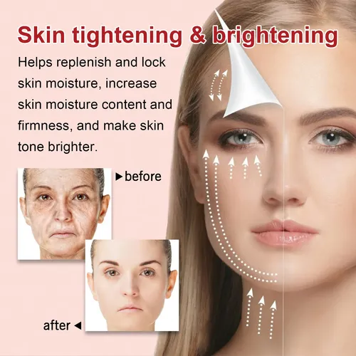 La Crema Facial De Ácido Kójico Jaysuing Aclara Las Manchas