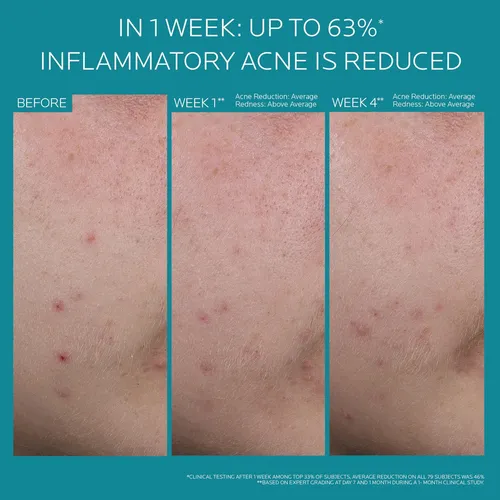 Crema Para El Tratamiento Del Acné La Roche-posay Effaclar B