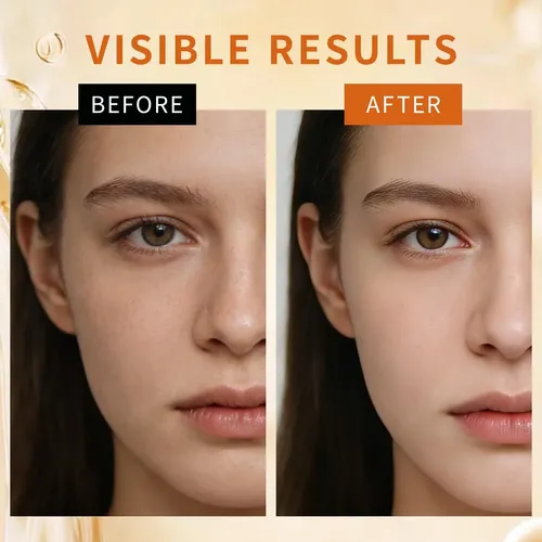Serum De Ácido Tranexámico 10% Con Niacinamida, Raíz De