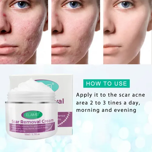 Crema For Aliviar Marcas Y Reparar Quemaduras Y Eliminar Ma