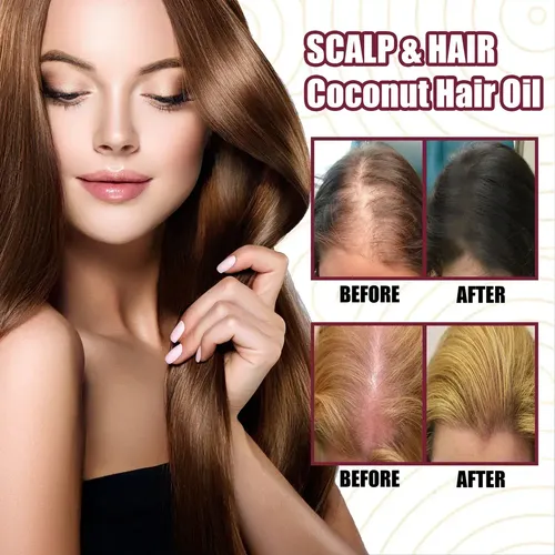 Caceite De Cebolla Para El Crecimiento Del Cabello 2pz .