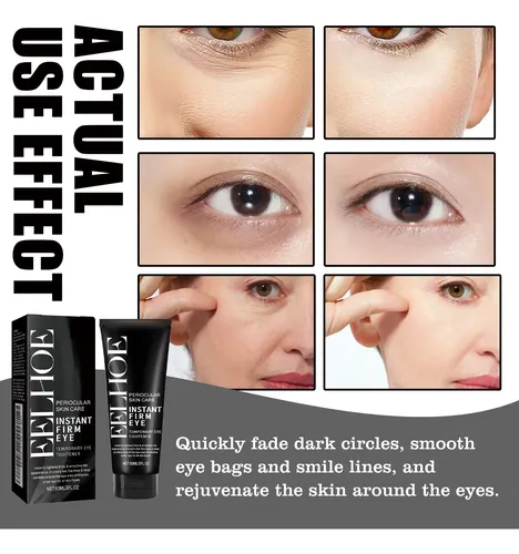 Eelhoe Eye Care Cream Crema Nutritiva Para Ojos Para La Zona De L
