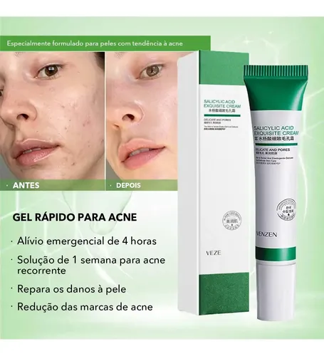 / Crema De Ácido Salicílico Para Eliminar Los Poros Del