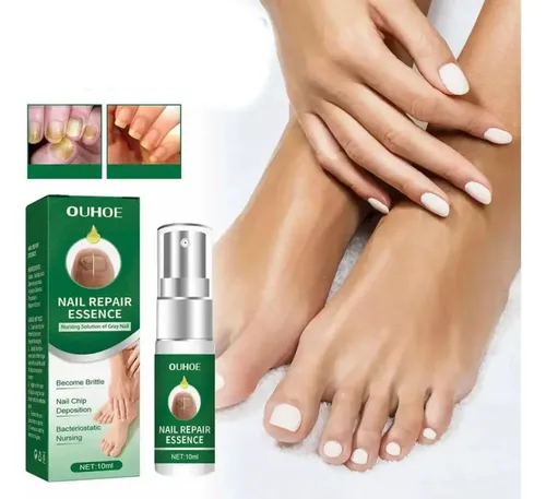 Suero Reparacion Uñas Ataca Hongos Onicomicosis 100% Calidad