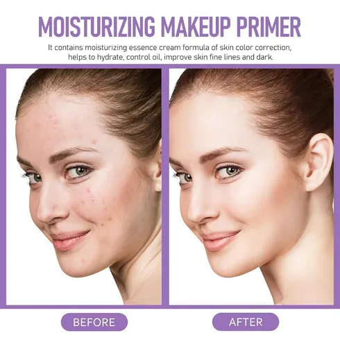Primer Facial Hidratante Skynest 160ml 3 En 1 Anti-manchas