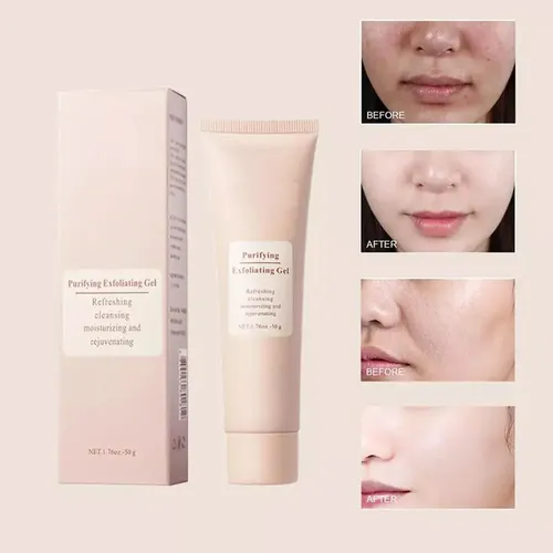3 Unidades De Gel Exfoliante Purificante Exfoliante,